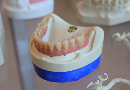 Pastebėjus dantų, dantenų ar liežuvio pokyčius svarbu nedelsti – apsilankymas odontologo kabinete gali padėti užkirsti kelią įvairioms sveikatos problemoms